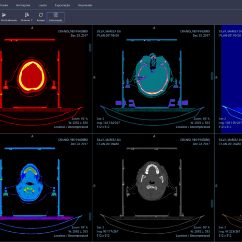 PACS and Artificial Intelligence