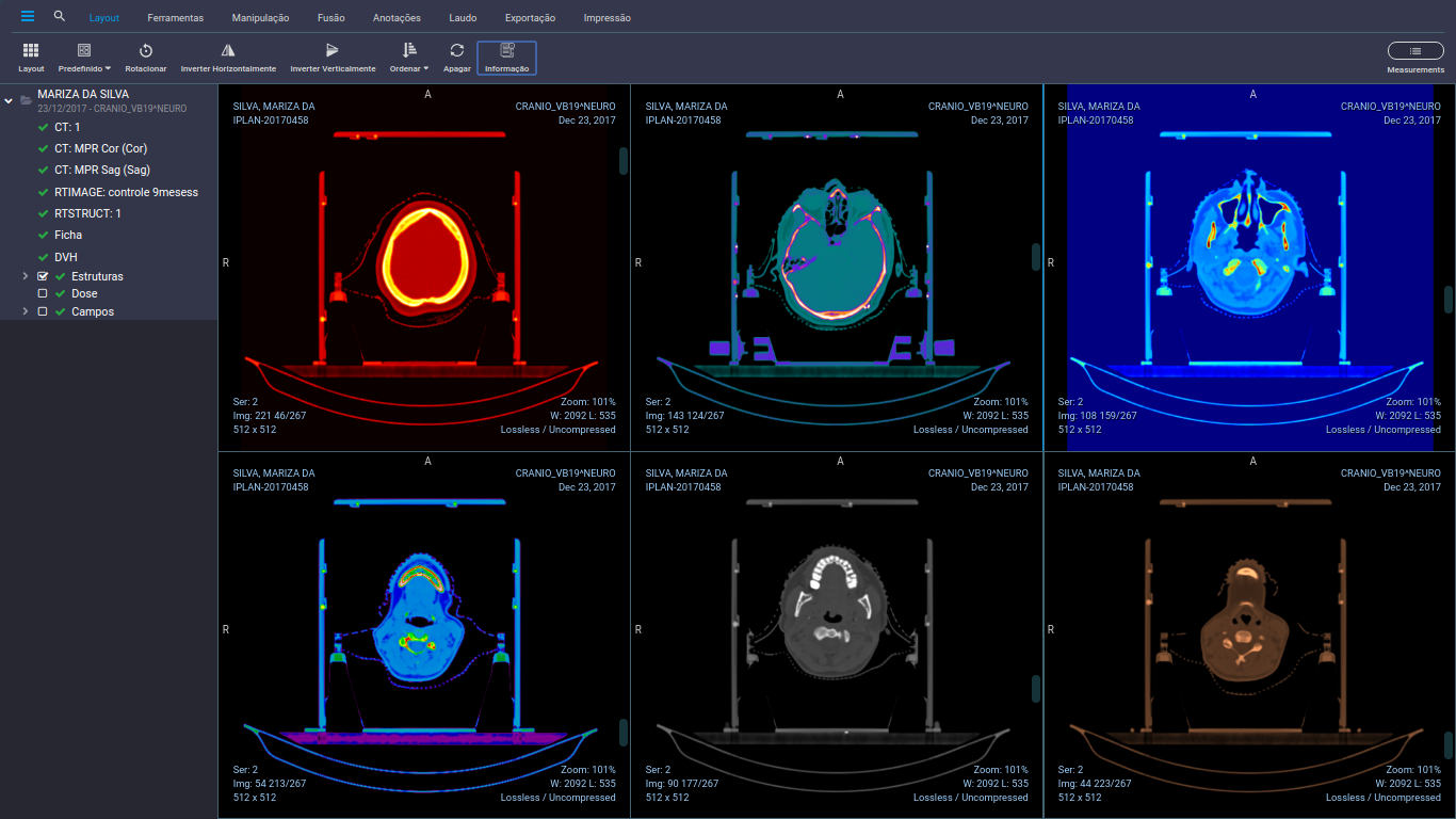 The Future of Medical Imaging with PACS Technology and AI