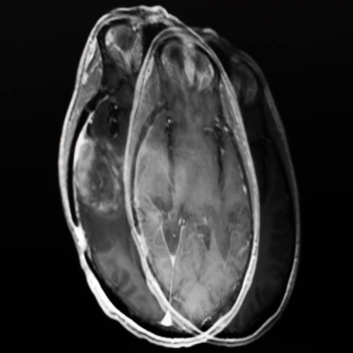 The Importance of Data Security in PACS Technology