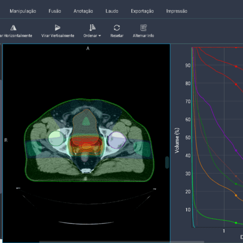 TG-263: Guia Completo de Padronização de Estruturas na Radioterapia