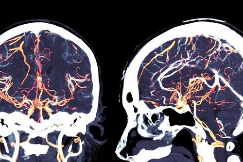 PACS: A chave para a Telemedicina eficiente e segura