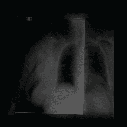 Ensuring agility and safety in the verification of radiotherapy portals: the importance of using automation software with CR