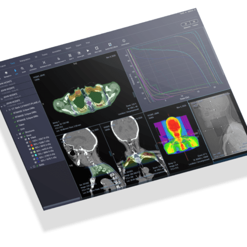 DICOM Viewer: Essential Features and Radiotherapy Images