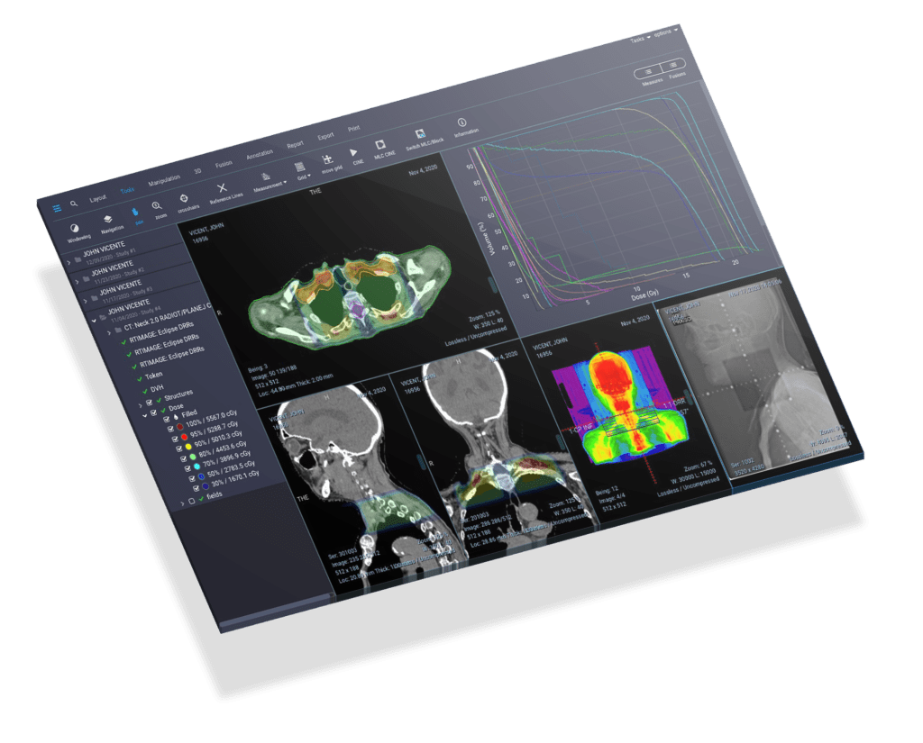 Medical Image Viewer in Radiotherapy
