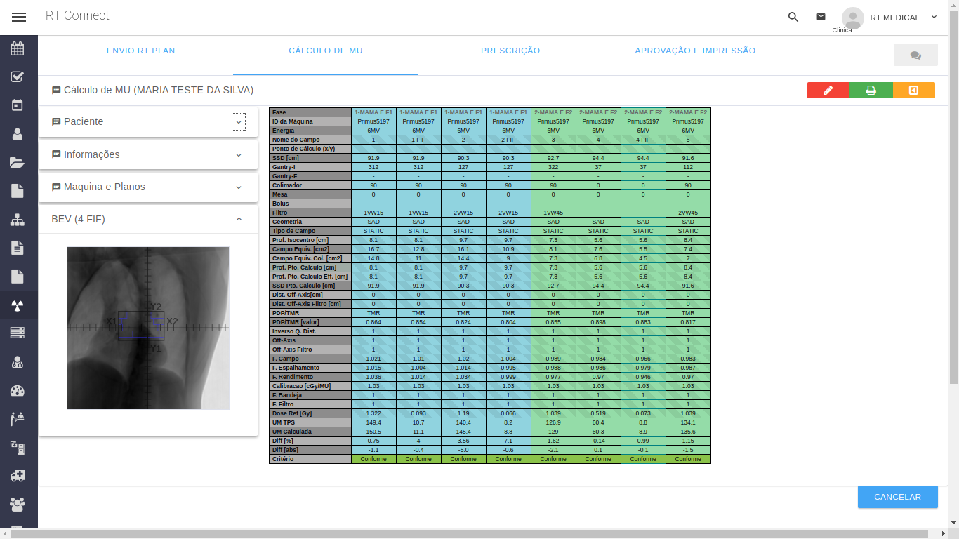 Top Features of Our Secondary Monitor Unit Calculation Software