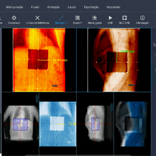 What are the differences between PACS, RIS, CIS, LIS and HIS?