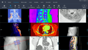 Exemplo de sistema PACS e Visualizador de Imagens