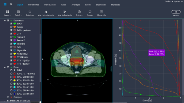 Monitor units (MU)? - RT Medical Systems