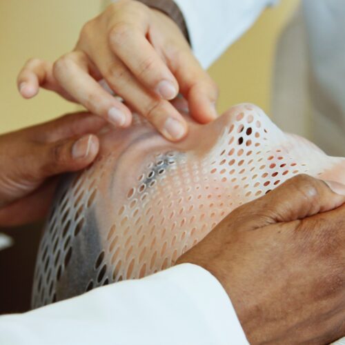 Immobilization devices for radiotherapy