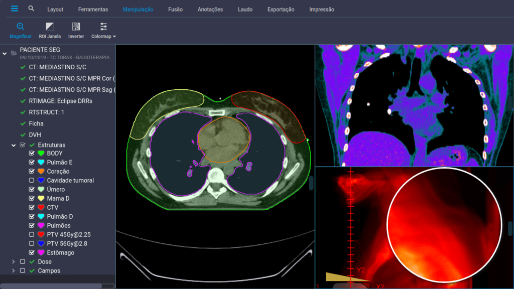 A Evolução do PACS e RIS: Uma Visão Geral Histórica