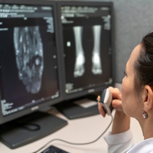 Entendendo o ACR-RSNA Common Data Element (CDE) e sua importância na radiologia