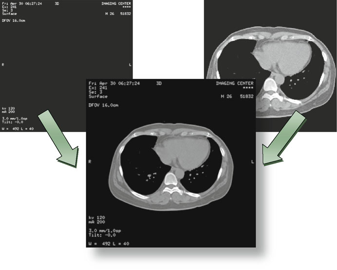 Tabela comparativa de codificação implícita e explícita de elementos de dados DICOM com exemplos binários