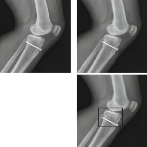 Objetos DICOM: Codificação de Dados e Estrutura SQ