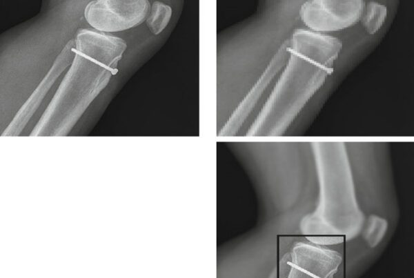 Diagrama de codificacao SQ mostrando aninhamento de objetos DICOM com elementos de dados em multiplos niveis