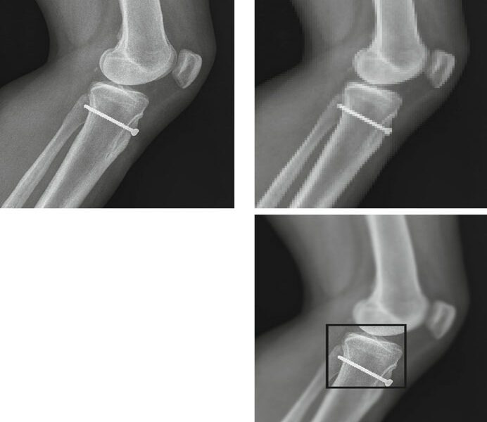 Diagrama de codificacao SQ mostrando aninhamento de objetos DICOM com elementos de dados em multiplos niveis