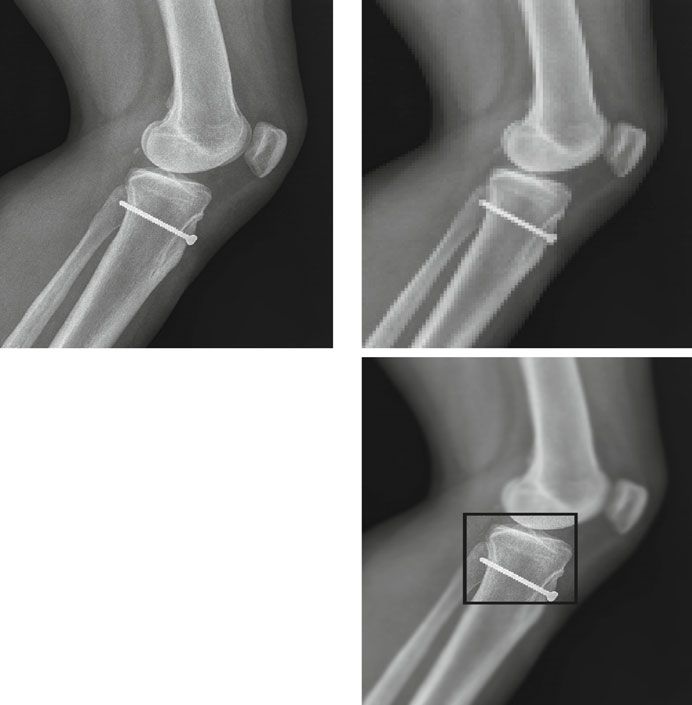 Objetos DICOM: Codificação de Dados e Estrutura SQ