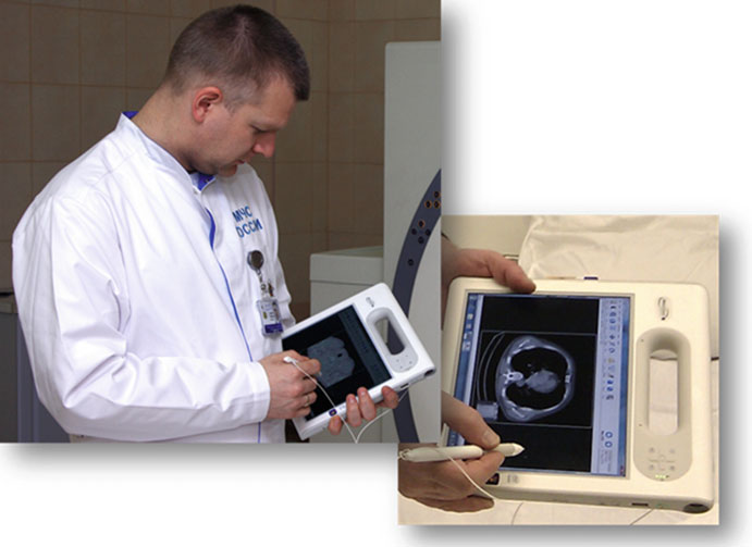 Médico visualizando imagens DICOM de tomografia craniana em tablet portátil conectado ao PACS