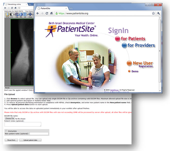 Portal web de teleradiologia PatientSite com interface de upload de arquivos DICOM e visualizador de imagens integrado