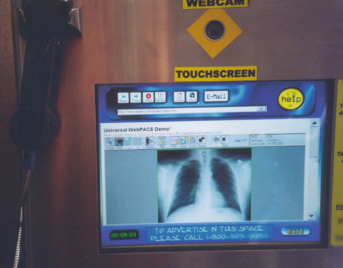 Quiosque touchscreen com visualizador WebPACS exibindo radiografia de tórax em ambiente público