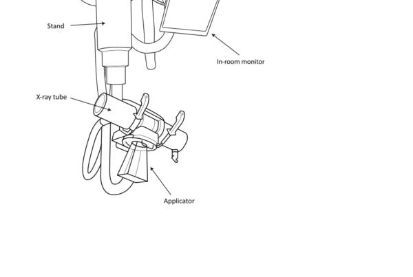 Figure 13: Features of an orthovoltage X-ray unit