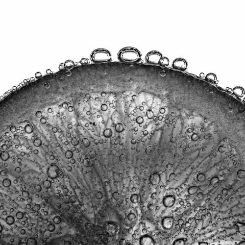 Modelos de IA Predizem Doenças via RM Cerebral