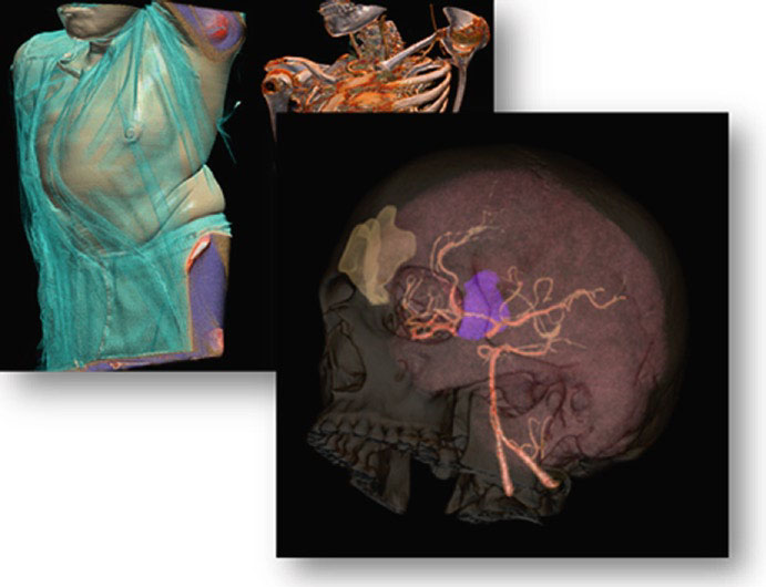 Diagrama de arquitetura PACS distribuída em nuvem com módulos independentes interconectados incluindo Basic PACS, Mobile PACS, PDA PACS, High-res PACS e Archiving PACS