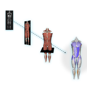 GE HealthCare e Springbok: IA e RM Muscular