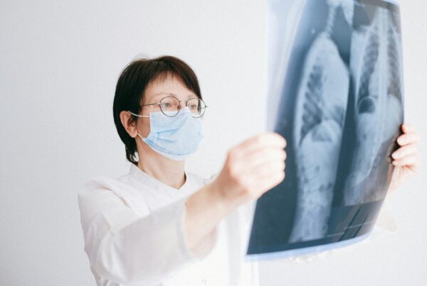 Médico analisando radiografia de tórax para rastreamento de câncer de pulmão com auxílio de IA