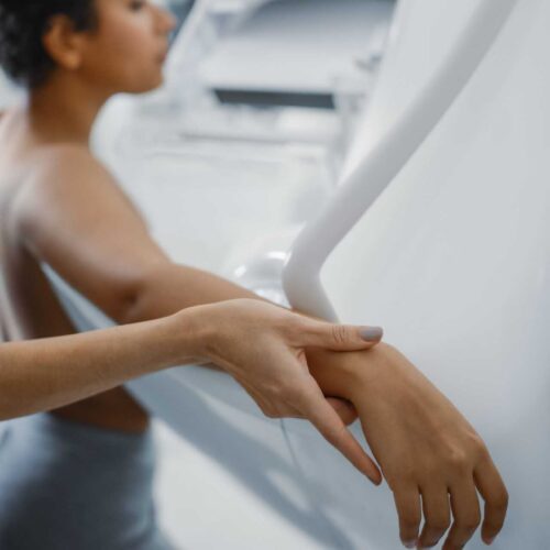 Mamografia Caiu Após Mudança de Diretriz do USPSTF em 2009