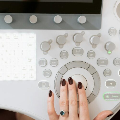 Ultrassom Guiado Revoluciona Tratamento do Túnel do Carpo