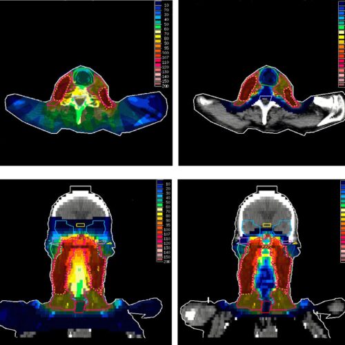 Monte Carlo para Fótons: Aplicações Clínicas