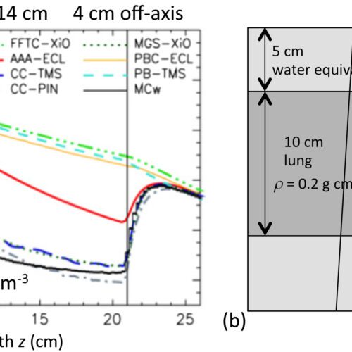 Pencil Beam, Fast Pencil Beam & AAA: Commercial Dose Algorithms