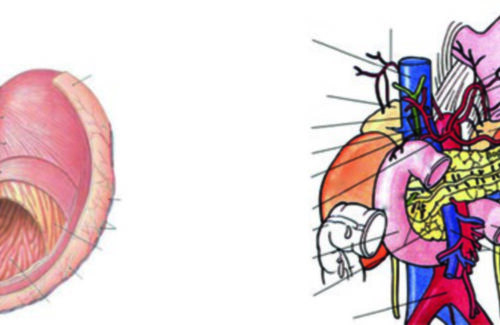 Câncer Gástrico: Delineamento e Planejamento RT