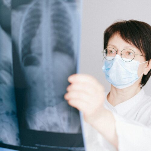 IA Estima Densidade Óssea de Crianças em Radiografia de Tórax