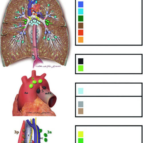 Câncer de Pulmão: Delineamento e Campos
