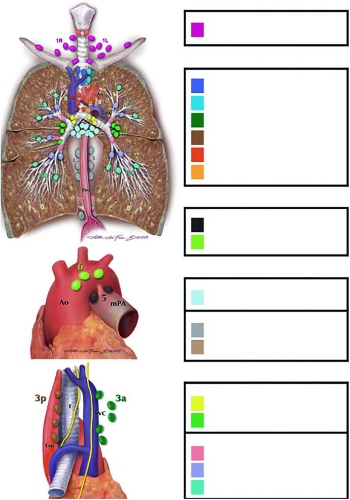 Câncer de Pulmão: Delineamento e Campos