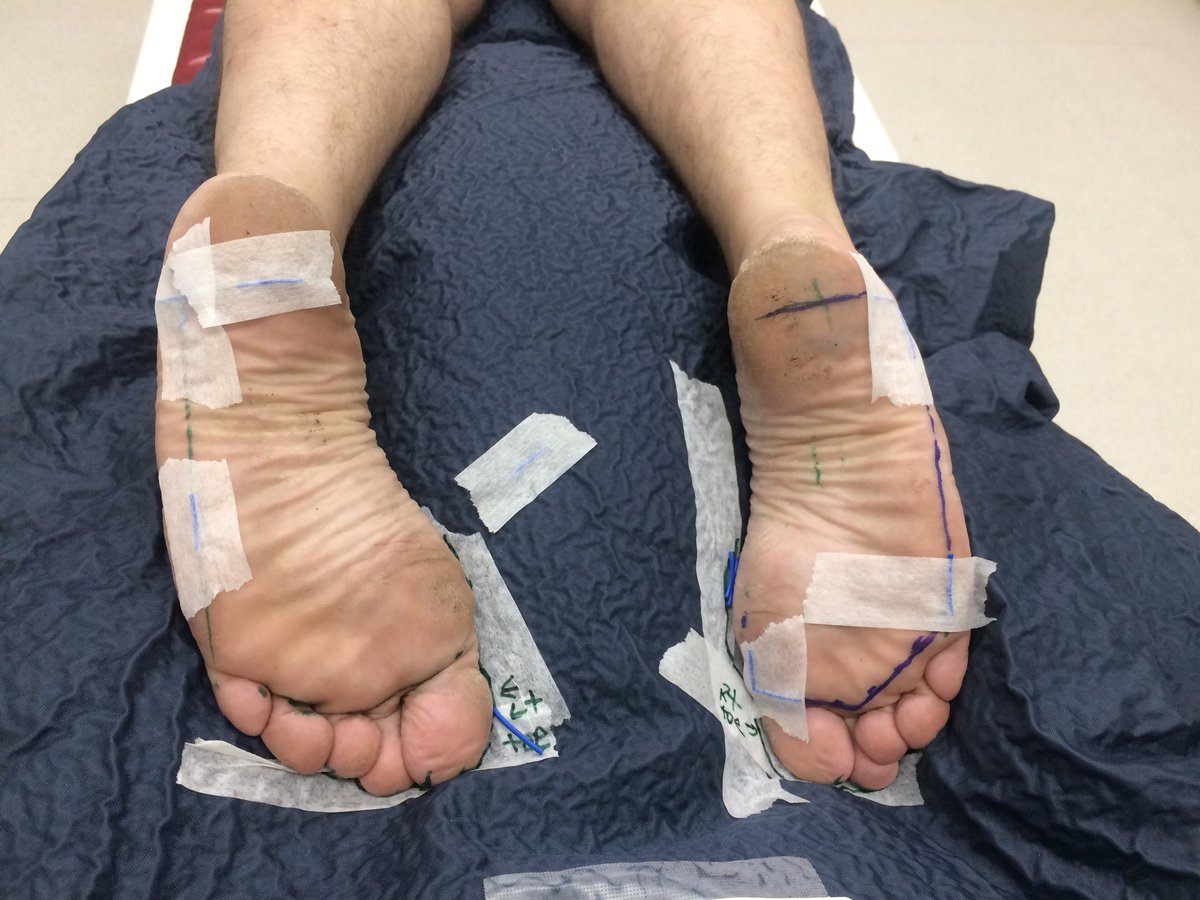 Tela de planejamento de tratamento de radioterapia (TPS)