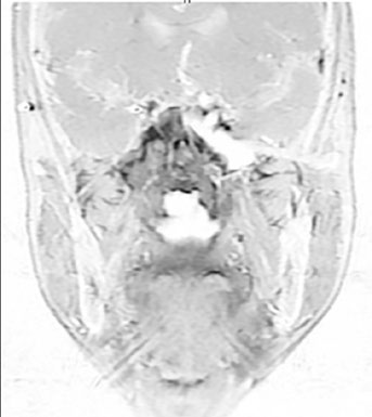 Replanificación adaptativa con RM