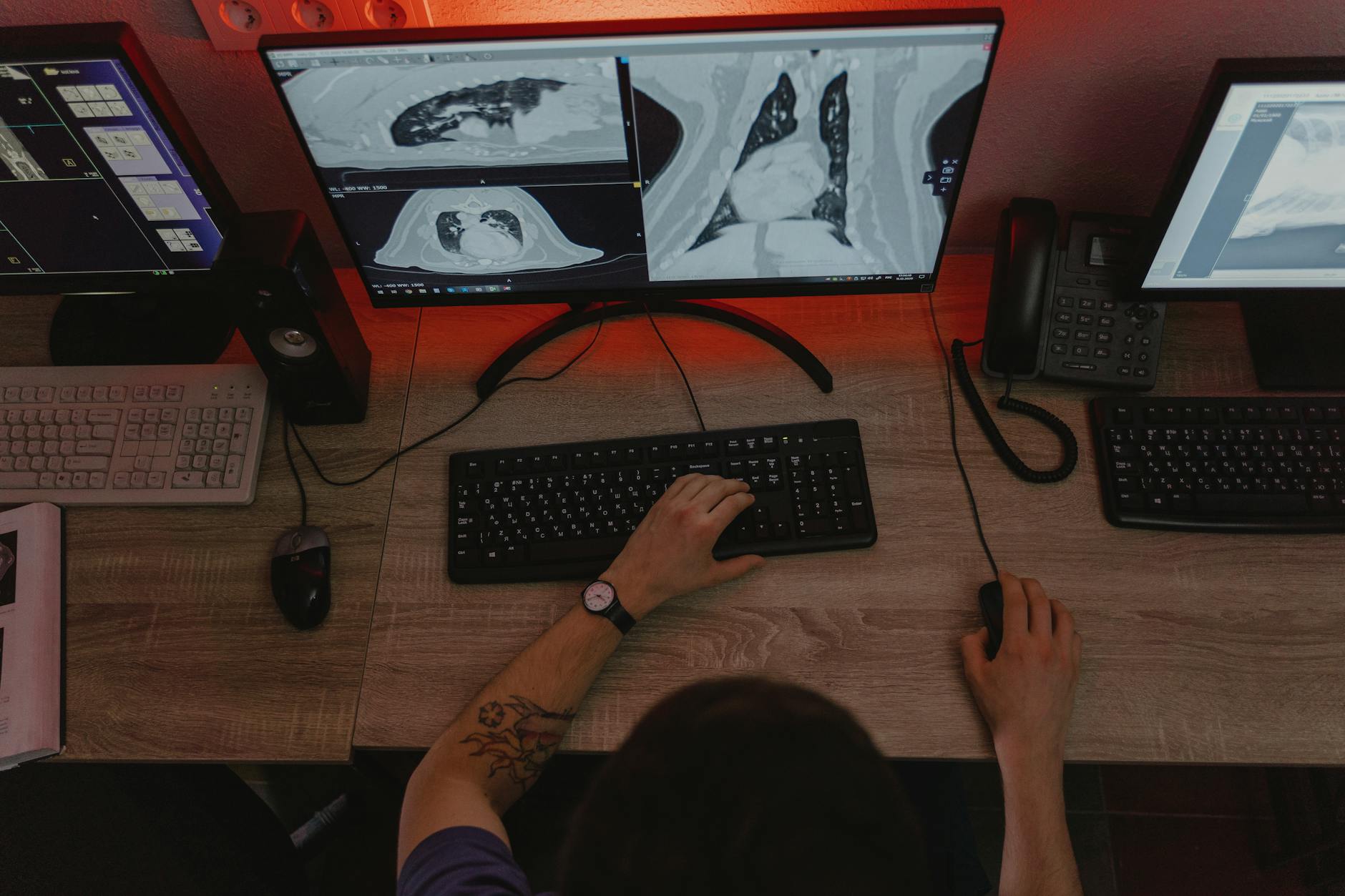 Most Radiologists Live With Musculoskeletal Strain