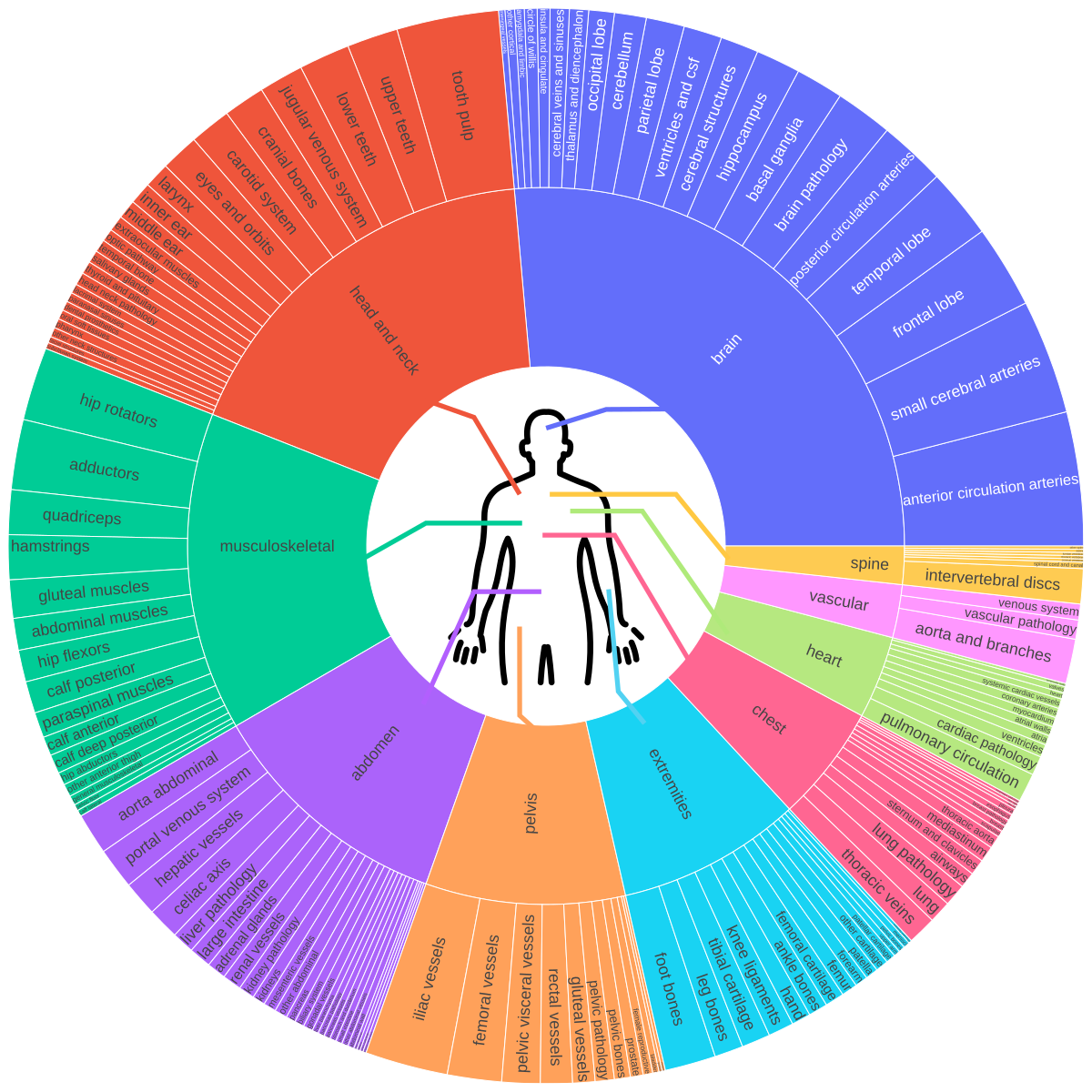 Diagrama conceptual de VoxTell-ESAPI mostrando escenarios de segmentación por prompt de texto en Varian Eclipse