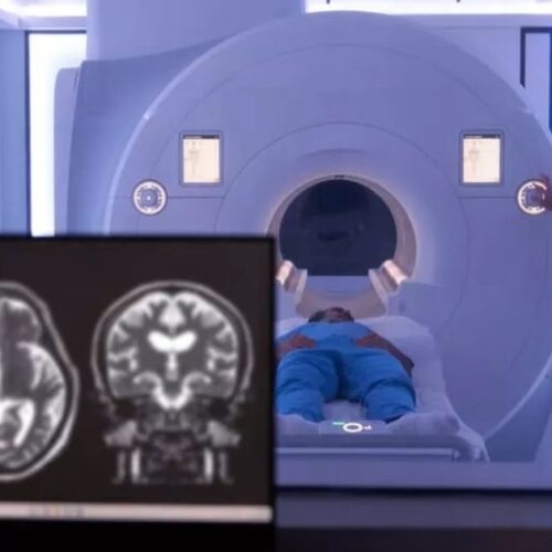 SimonMed Cobra Extra por IA: US$ 50 por Análisis Adicional