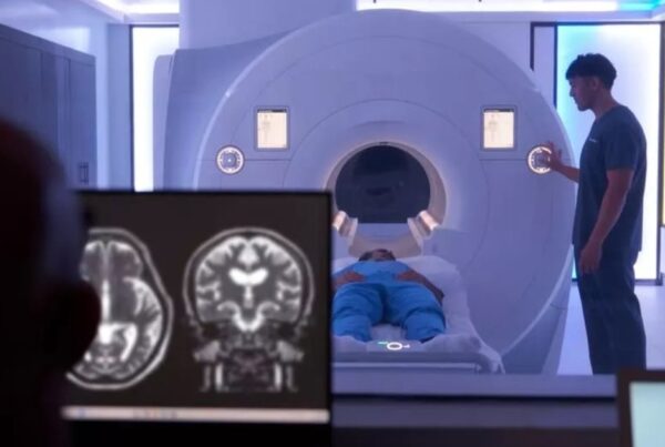 Sala de ressonância magnética em centro de imagem SimonMed com plataforma AI integrada