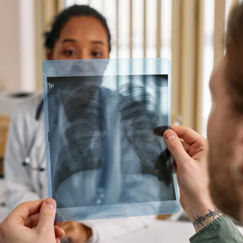 Crack Lung: Radiology Case Highlights Imaging Pitfalls