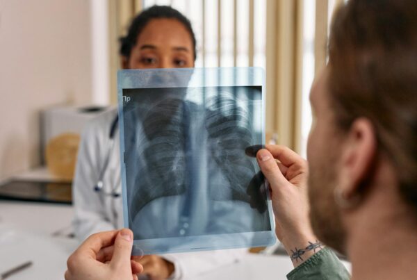 Radiografia de torax: pulmao do crack pode mimetizar pneumonia bacteriana