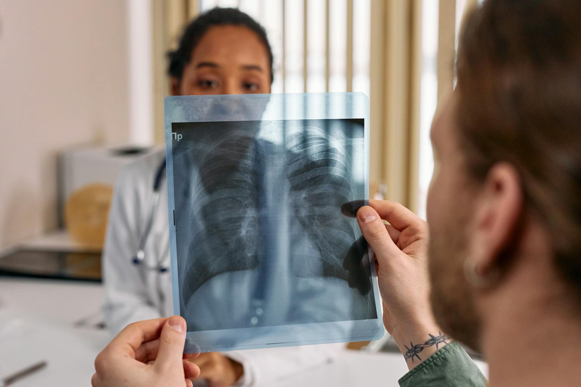 Pulmon del Crack: Caso Radiologico y Diagnostico