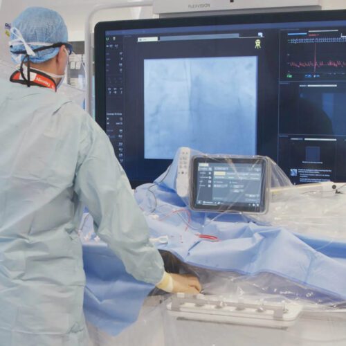 Philips SmartIQ Cuts Cath Lab Radiation on Azurion