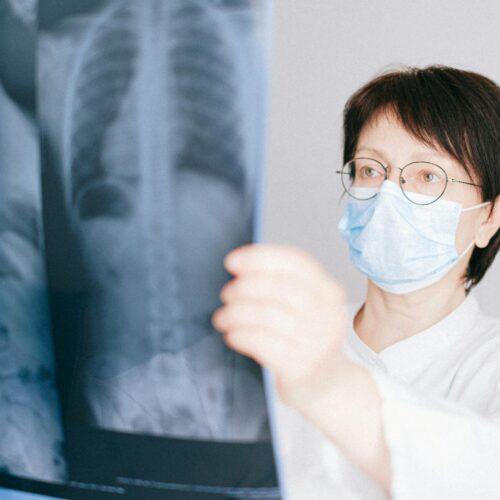Chest X-Ray AI Algorithms Show Wide Performance Gaps