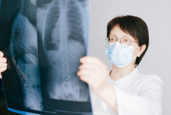 Radiografia de torax sendo analisada por algoritmos de IA para cancer de pulmao