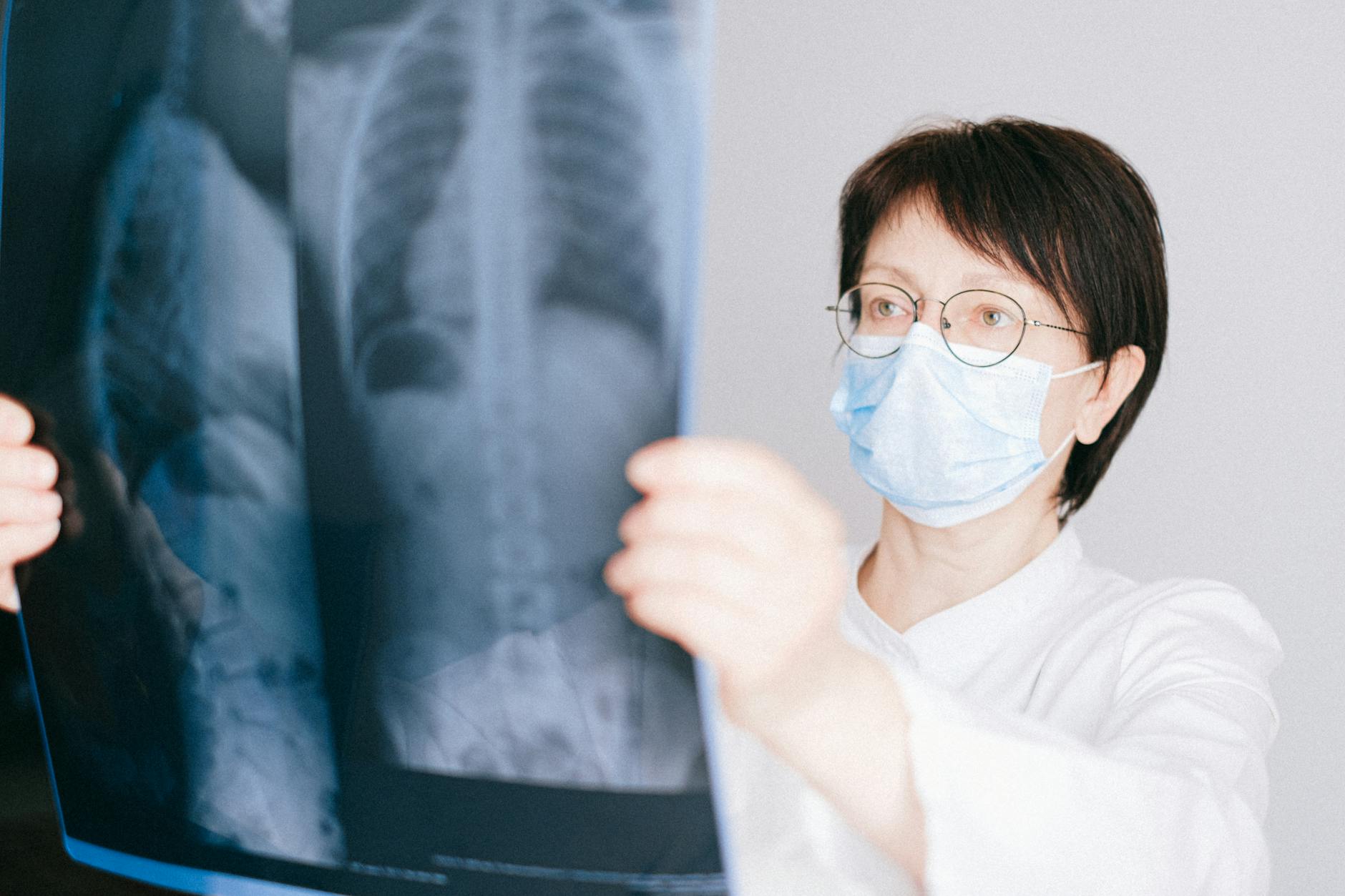 Chest X-Ray AI Algorithms Show Wide Performance Gaps