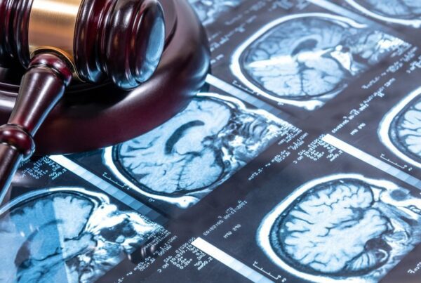 Imagem ilustra processo de erro diagnostico em radiologia: cerebro e martelo legal